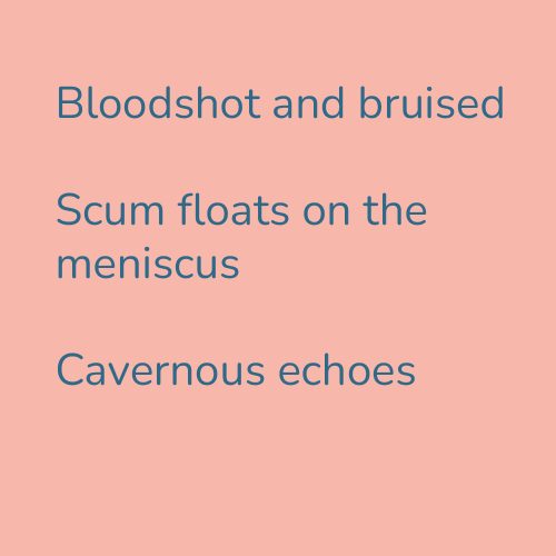 Bloodshot and bruised