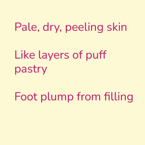 Pale, dry, peeling skin